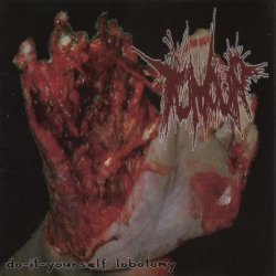 Tumour & Anal Penetration ‎– Do-It-Youself Lobotomy & The Daily Drop (2006)